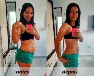 img-antes-depois-bc-cibele-a6a0a7f6-300x244-1.webp